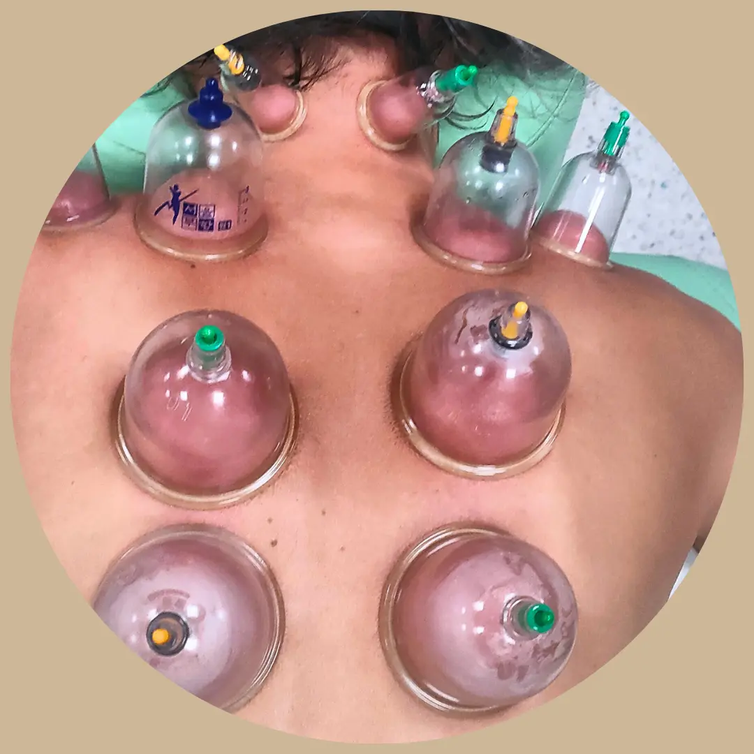 terapia próżniowa twarzy Inowrocław – naturalny lifting i drenaż limfatyczny